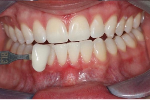 Emergency Dentist