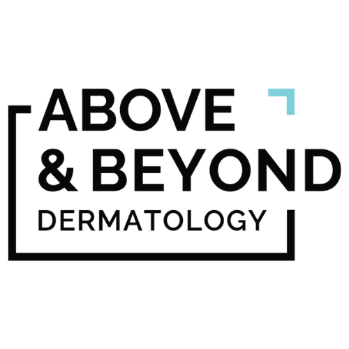 Above & Beyond Dermatology on FB