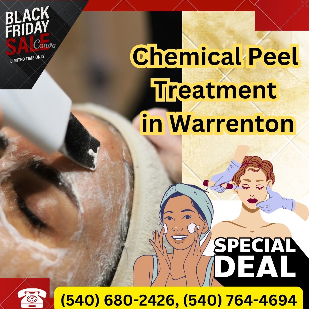 Black Friday Special: Chemical Peel